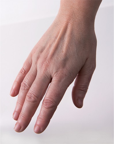 Viscoderm Hands - After